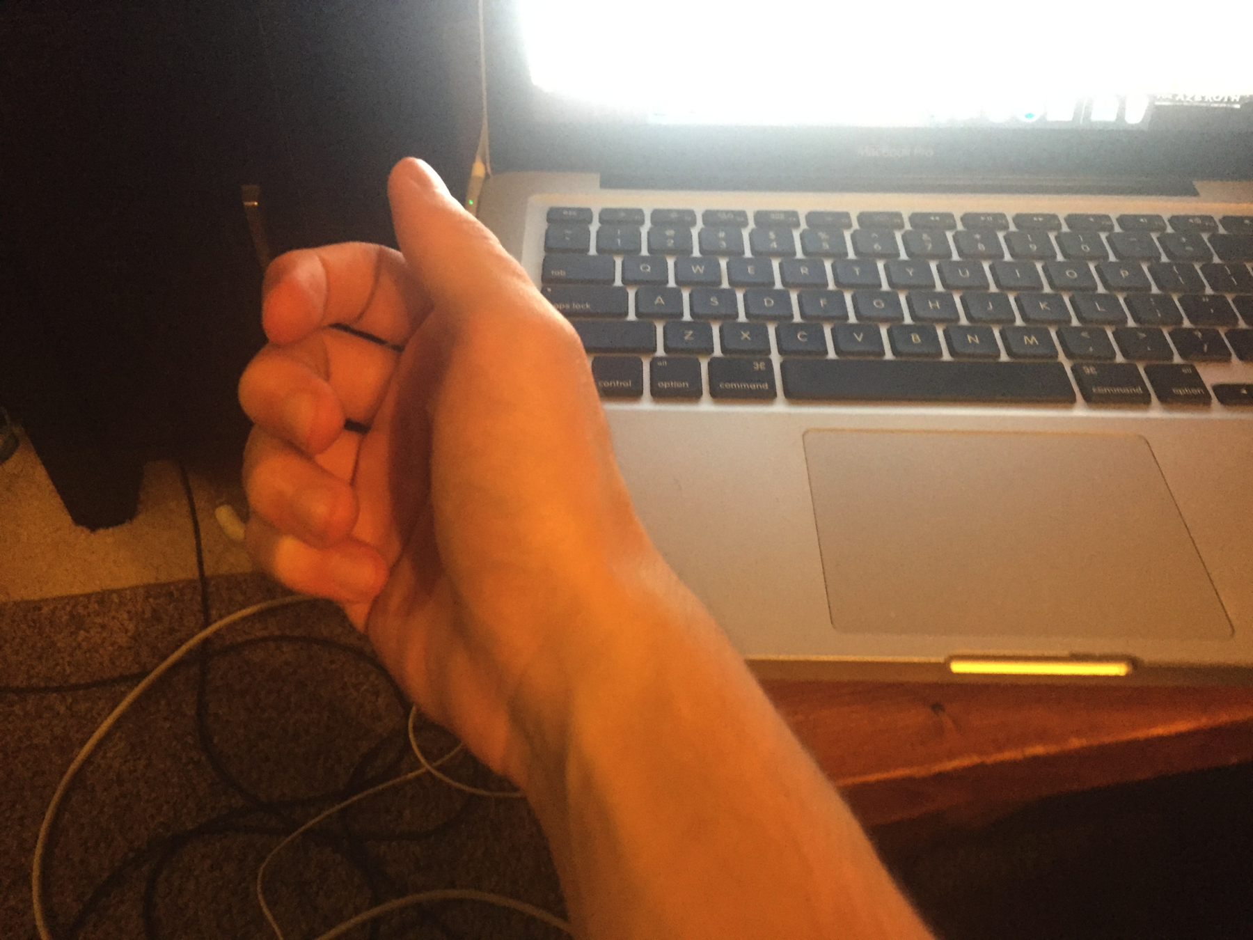 Wrist in front of a computer